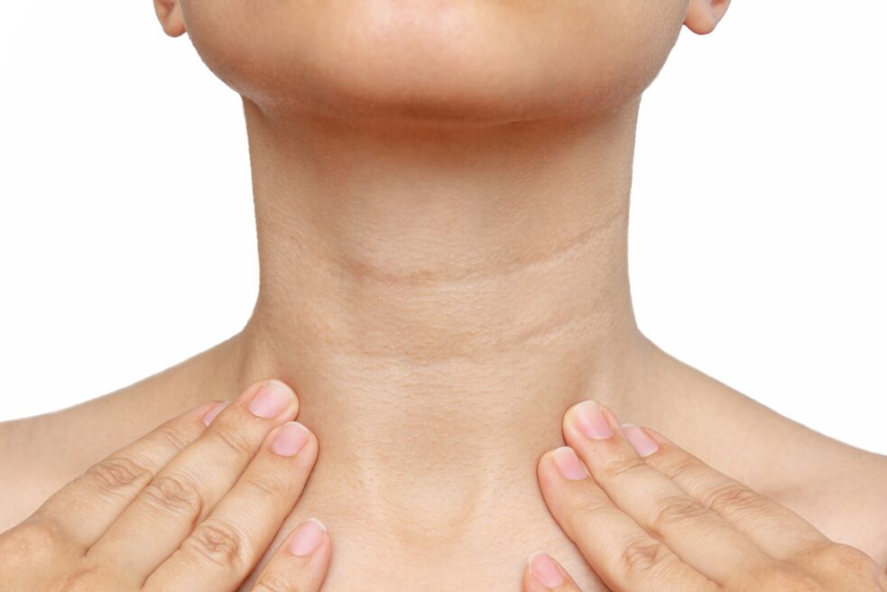 Arrugas en el cuello y su eliminación de crema zxcvbnmqwort
