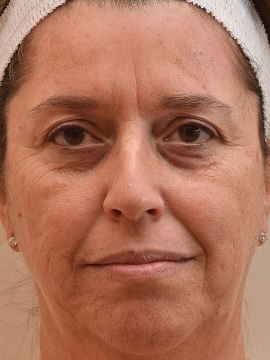 Así que miré antes del uso de la crema Eudalie