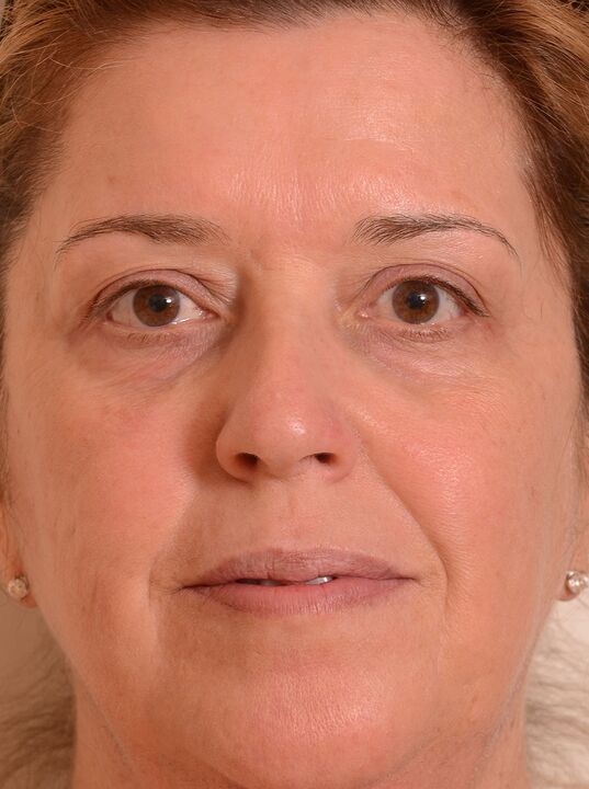 Rejuvenecí mi cara con crema Eudalie