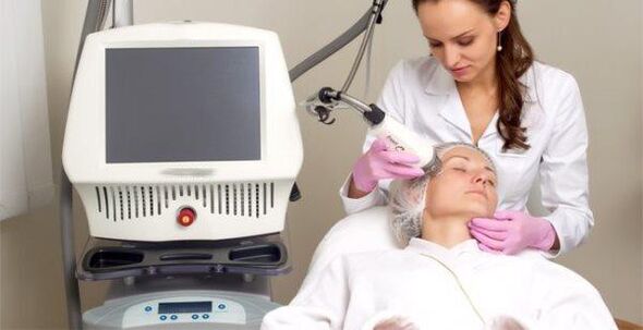 Realización del procedimiento