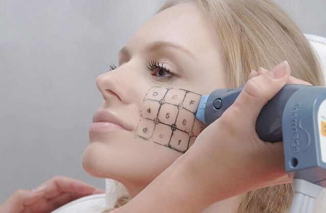 Procedimiento termal